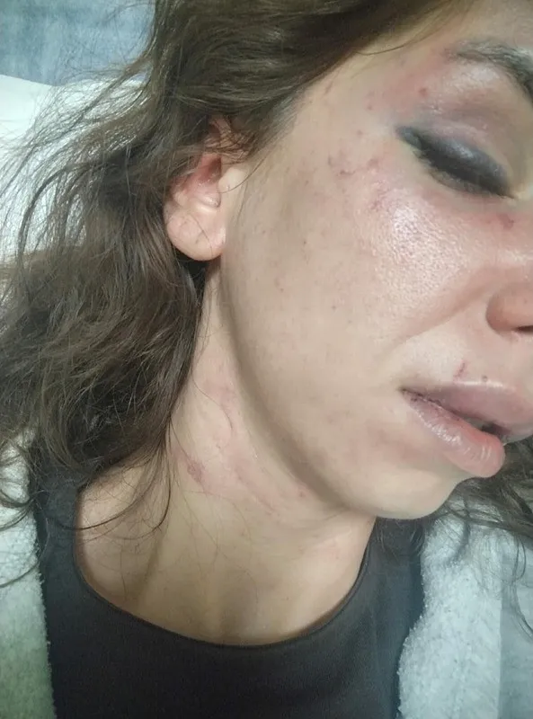 oldugunu-sandi-yumruklarla-uyandi-magdur-kadin-saatler-suren-iskenceyi-anlatti-1788683096558.jpeg