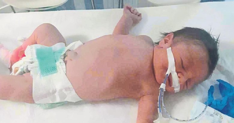 Leo bebek yaşayacak