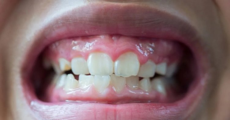 Her gün kola içtiğimizde oluşan etkileri: Fazla kola içmek zararlı mı?