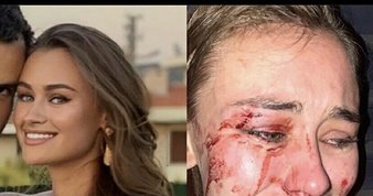 Kültür ve Turizm Bakanı Ersoy’dan Çeşme’deki darp olayına tepki: Bu kabul edilemez