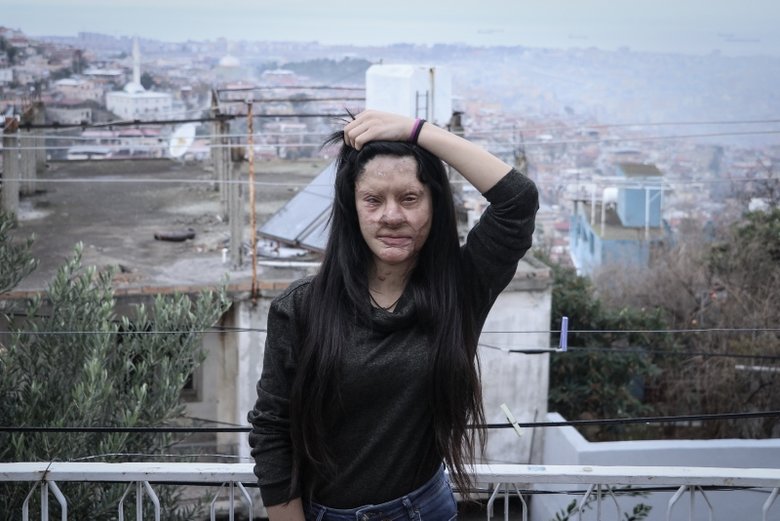 Berfin Özek olayı nedir? Berfin Özek’e ne oldu?