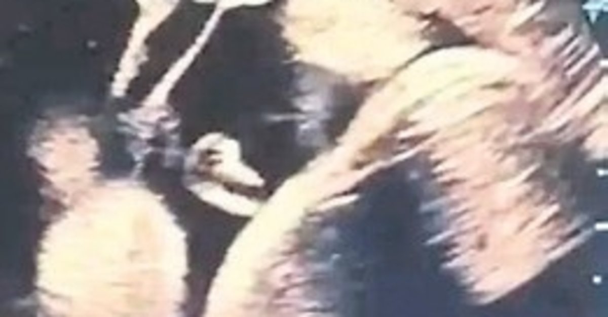 Anne karnındaki bebeğe doktoru kan verdi