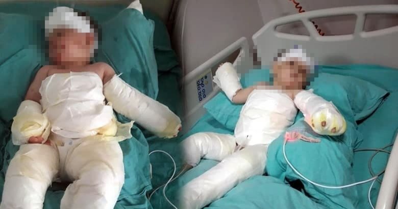 İzmir’de akılalmaz olay! Eşinin ve 1,5 yaşındaki oğlunun üzerine kolonya dökerek yaktı