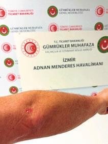 İzmirli çiftten ‘havaalanında darp’ iddiası