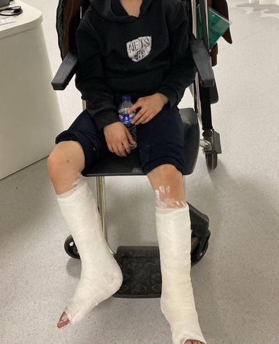 Kütahya’da 12 yaşındaki çocuğa sokak köpeği saldırdı