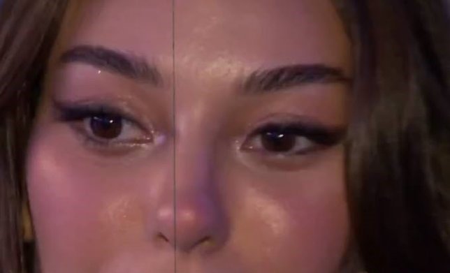 Dilan Çiçek Deniz’in son halini görenler gözlerine inanamıyor