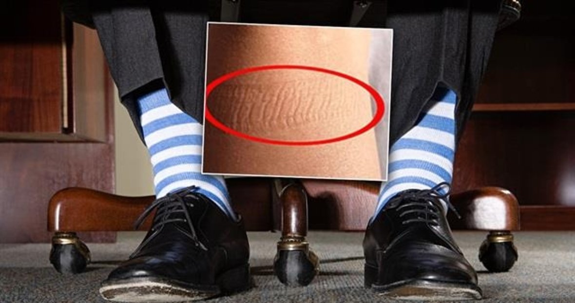 Kalbin Duzgun Calismadigini Gosteren 8 Isaret Kalp Hastaligi Nasil Anlasilir Yasam Haberleri