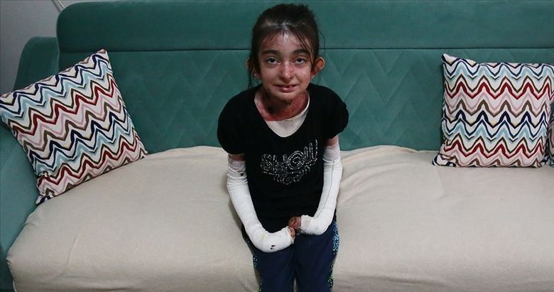 ’Kelebek çocuk Elfida’ hayatını kaybetti