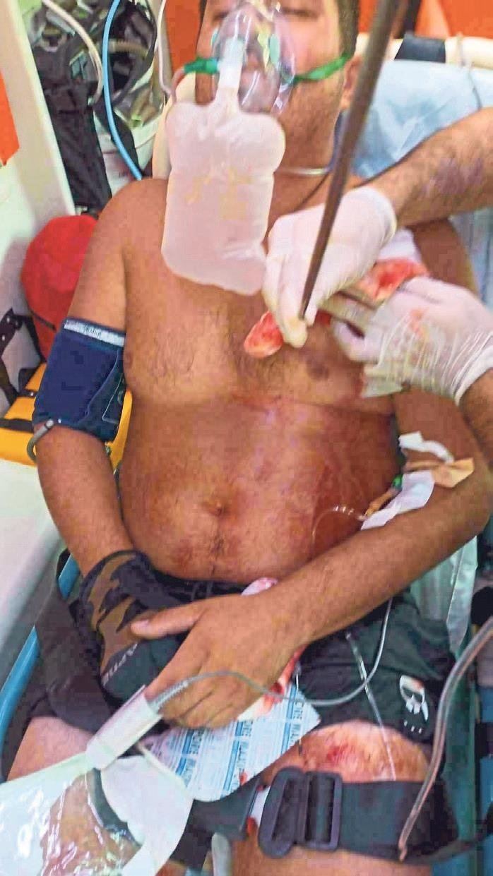 Ölümden döndü avdan dönmedi