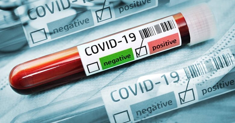 Son dakika: Sağlık Bakanlığı 12 Aralık 2021 koronavirüs vaka tablosunu paylaştı