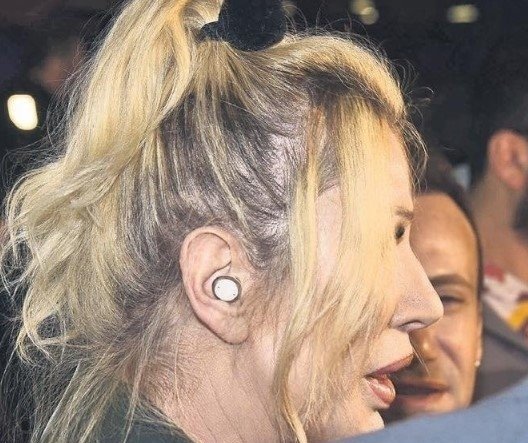 Ünlü sanatçı sevenlerini korkuttu! Seda Sayan’ın kulaklarına ne oldu?