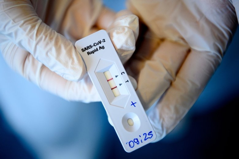 Bilim Kurulu Üyesi uyardı: Temaslınızı saklamak pandemiyi uzatır