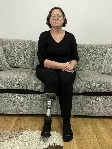 İzmir’deki depremde bacağını kaybetmişti: Tekrar bisiklet süreceği günlerin hayaliyle yaşıyor
