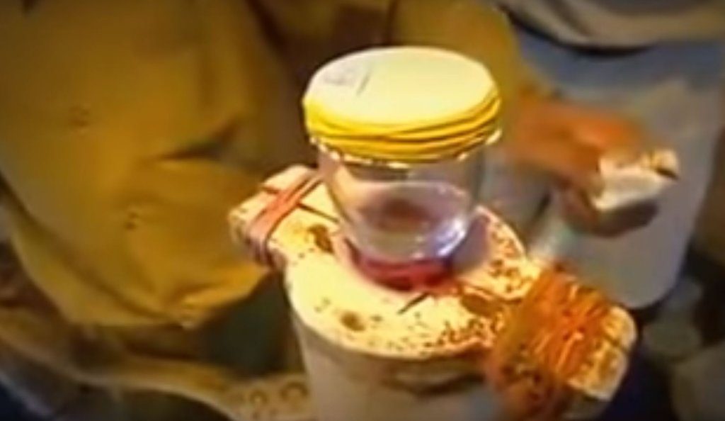 Yılan zehri kanı bakın ne hale getirdi! Görenler dehşete düştü