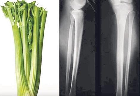 Benzediği organa fayda sağlayan besinler