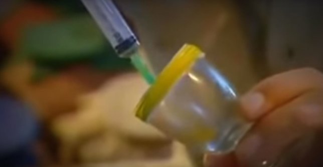 Yılan zehri kanı bakın ne hale getirdi! Görenler dehşete düştü