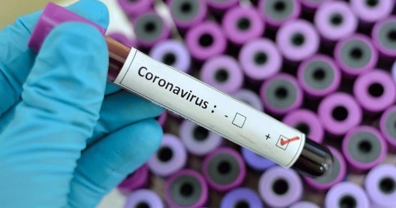 Son dakika: Sağlık Bakanlığı 16 Ocak 2022 Kovid-19 vaka ve vefat sayılarını açıkladı