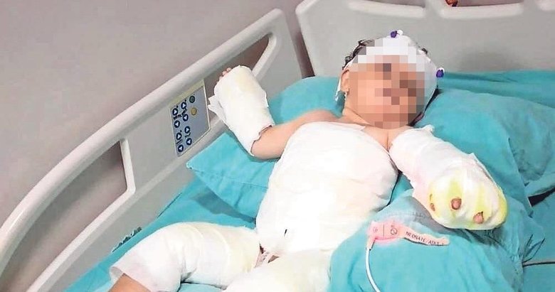 Eşini ve oğlunu üzerlerine kolonya dökerek yaktı