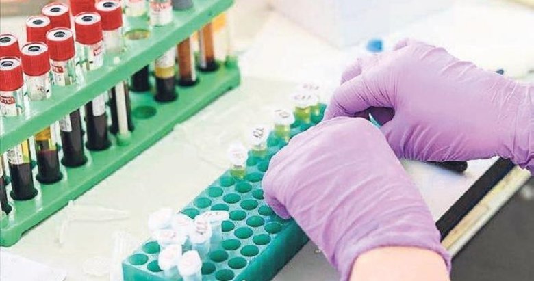 Evlilik öncesi ücretsiz SMA testi