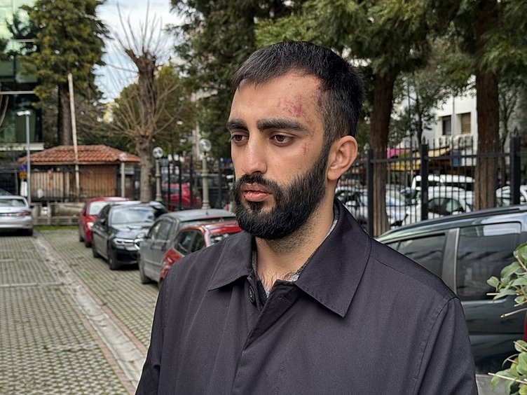 İzmir’de feci olay! Önce köpekler sonra sahipleri saldırdı