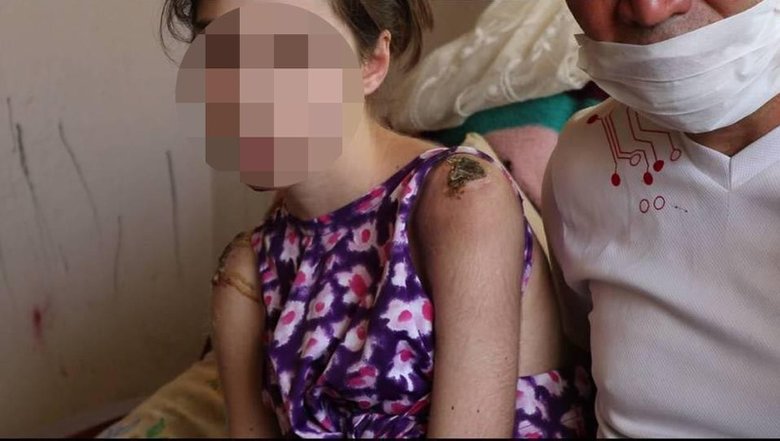 İzmir Foça’da kan donduran iddia! Üvey babadan iki kardeşe keser sapıyla şiddet