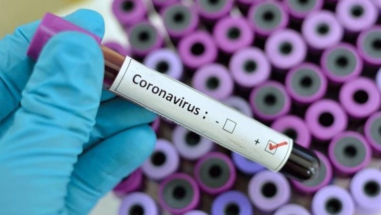 İtalya’da koronavirüsten ölen ilk hasta hakkındaki detay şok etti