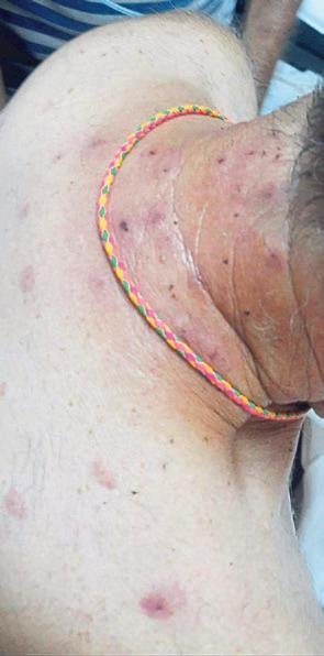 Doga yürüyüsünde yüzlerce arı saldırdı