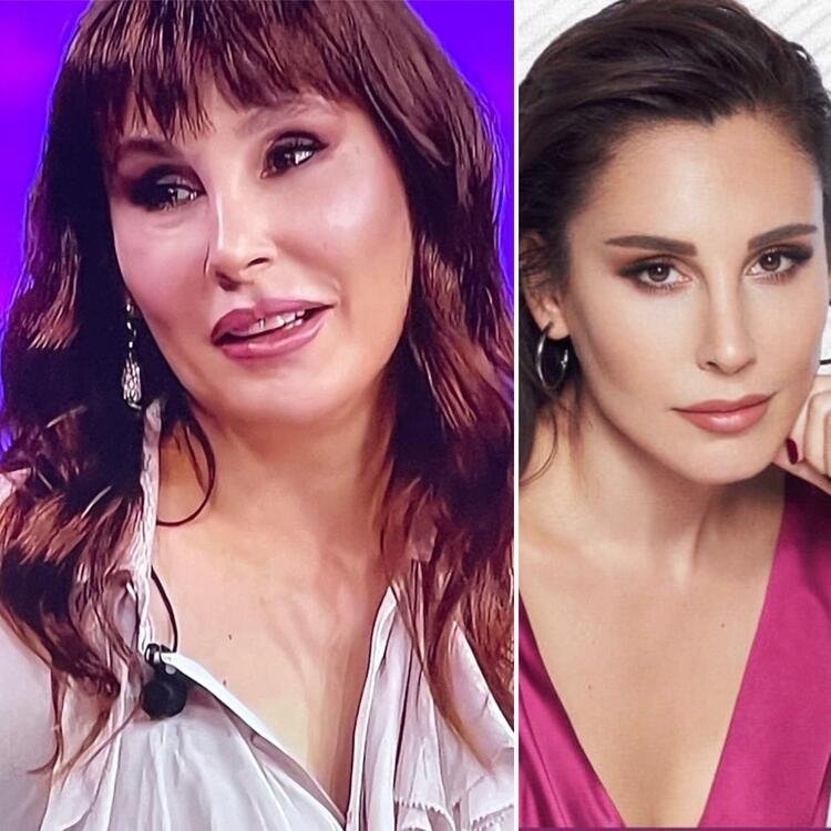 Cam Tavanlar’ın Leyla’sı Bensu Soral estetiksiz haliyle şaşkına çevirdi