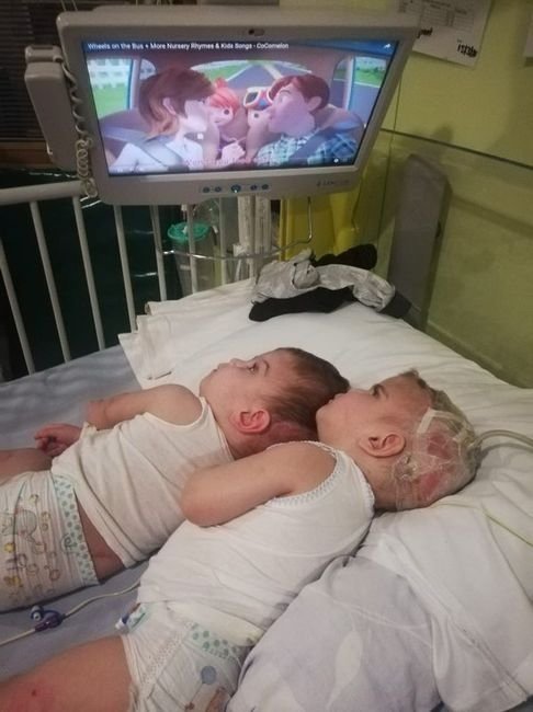 Son dakika: Başkan Erdoğan siyam ikizlerinin ailesiyle görüştü