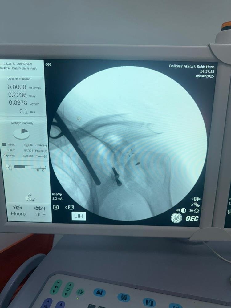 Balıkesir’de ilk defa latarjet omuz ameliyatı gerçekleştirildi
