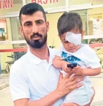 Köpek saldırısına uğrayan minik Yiğit’in durumu ağır