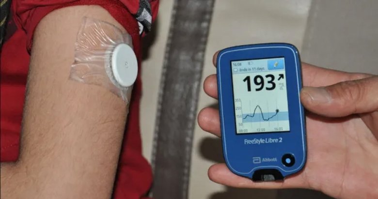 Sensörlü şeker ölçüm cihazı SGK kapsamına alındı