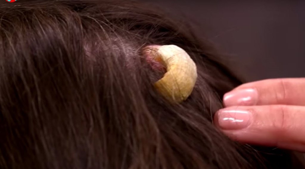 Bilim insanları şaşkın! Kafasında boynuz çıktı...