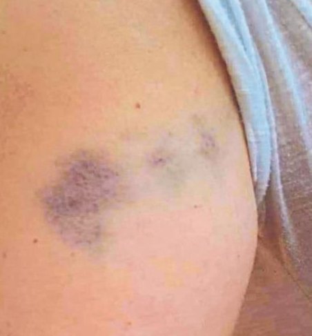 ‘Ya ölecekti ya öldürecekti’