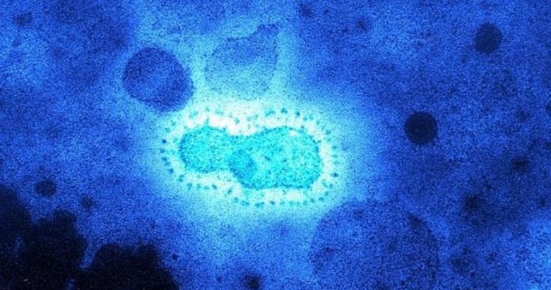 Binlerce yıllık buzda 28 yeni virüs keşfedildi