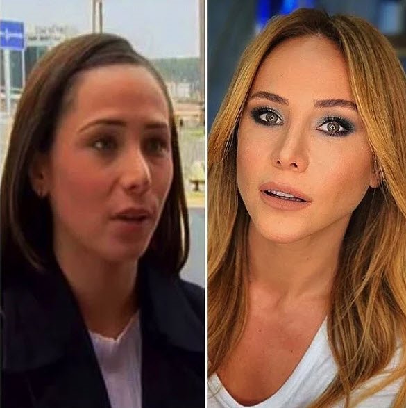 bir zamanlar cukurova nin zuleyha si sosyal medyayi salladi hilal altinbilek estetiksiz haliyle galeri yeni asir