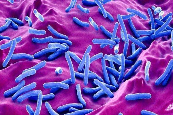 Tüberküloz nedir? Tüberküloz bulaşıcı mı? Tüberküloz tedavisi nasıl?