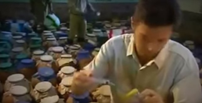 Yılan zehri kanı bakın ne hale getirdi! Görenler dehşete düştü