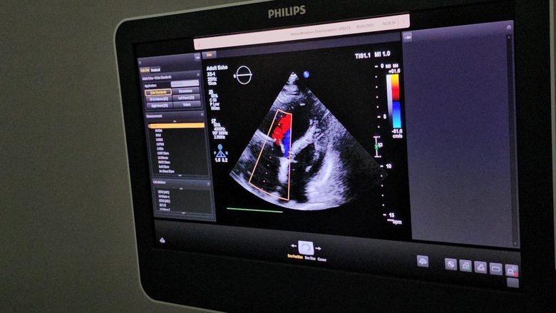Türkiye’de bir ilk! Aydın’da bir hastanın kalbine ulaşan cisim ameliyatsız şekilde çıkarıldı
