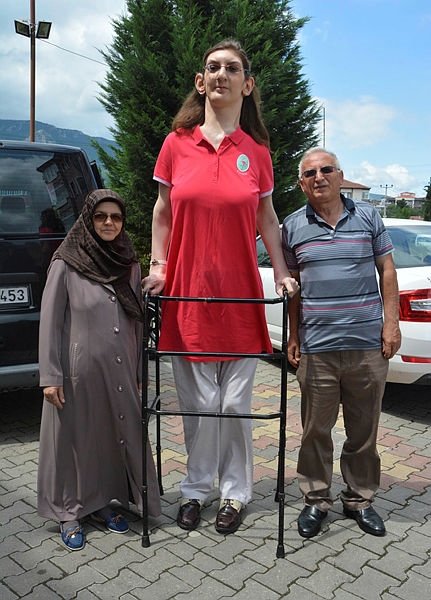 Dünyanın en uzun kadını ikinci kez ’Guinness Rekorlar Kitabı’nda