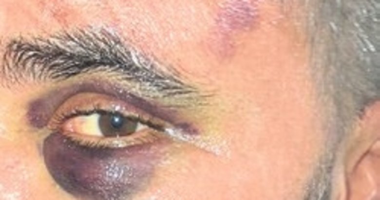 İşyeri sahibi dükkanında öldüresiye darp edildi