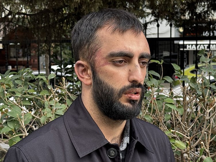 İzmir’de feci olay! Önce köpekler sonra sahipleri saldırdı