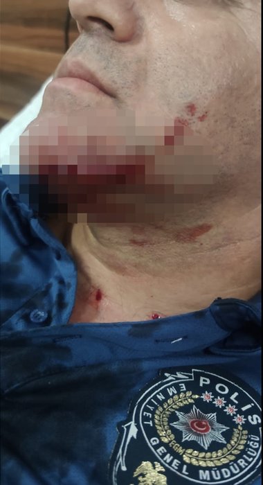 İzmir’de polisi bıçaklayan saldırgan serbest bırakıldı!