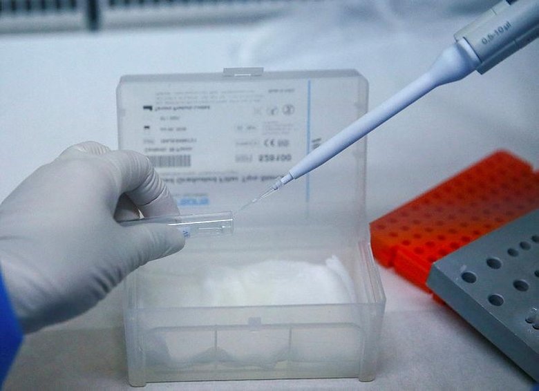 İzmir’deki PCR laboratuvarında 5 örnekten biri pozitif çıkıyor