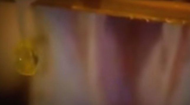 Yılan zehri kanı bakın ne hale getirdi! Görenler dehşete düştü