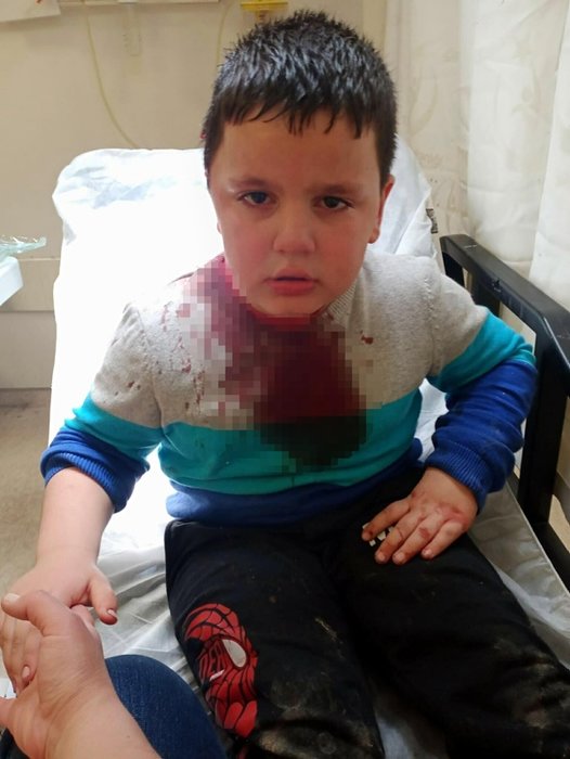 İzmir’de pitbull dehşeti! Küçük çocuğu hastanelik etti