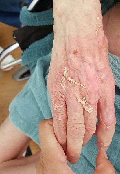 İzmir’deki huzurevinde yaşanan olayla ilgili rapor: Fatma nine, sıcak suyla yıkadıkları için yanarak ölmüş