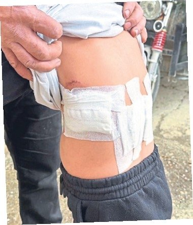 Vukuatlı eşek, 5 yaşındaki çocuğa kabusu yaşattı