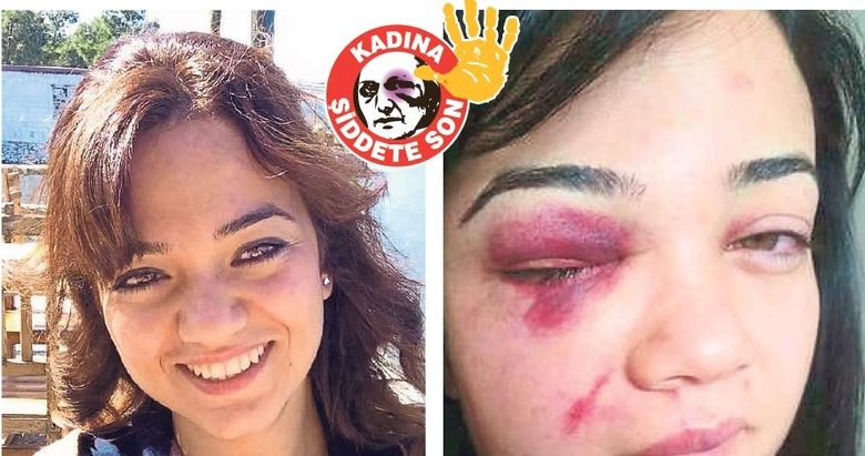 Zeliha tam 46 kez şikayetçi oldu! 47’nci çığlık!