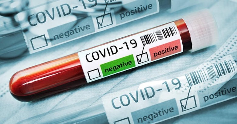 Uzman isim uyardı: Koronavirüs gripten daha bulaşıcı